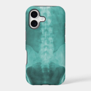 Digital X-Ray Art iPhone 5 Case