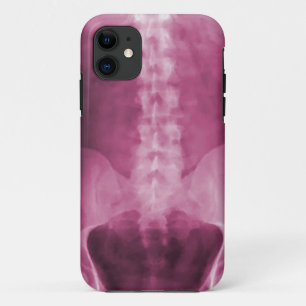 Digital X-Ray Art iPhone 5 Case