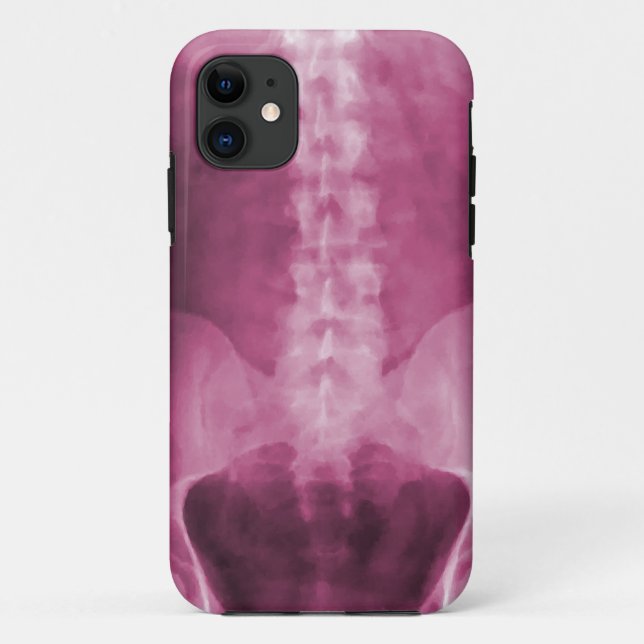 Digital X-Ray Art  iPhone 5 Case (Back)