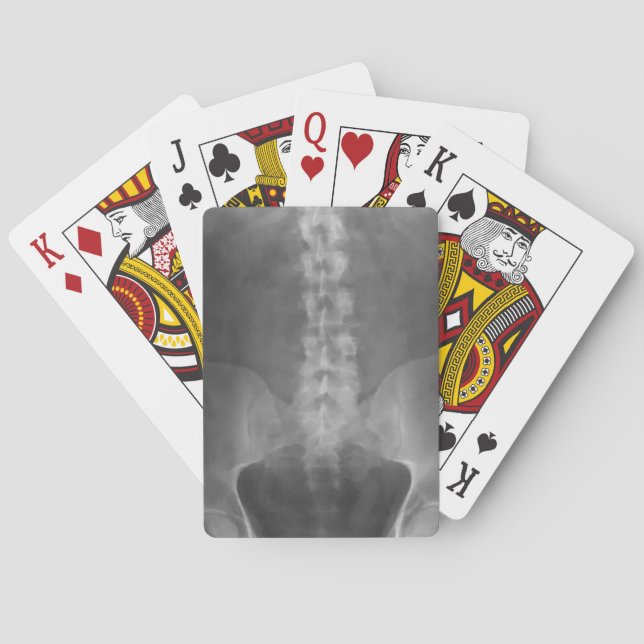 Digital X-Ray Art Playing Cards (Back)