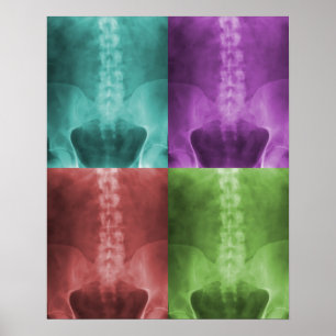 Digital X-Ray Art Print