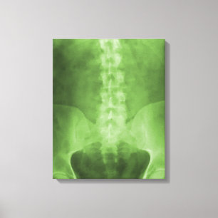 Digital X-Ray Art Wrapped Canvas
