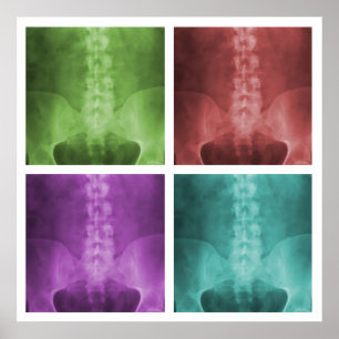 Digital X-Ray Pop Art Square Poster