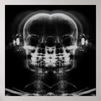 Double X-Ray Skulls with Headphones - B&W Poster