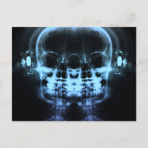 Double X-Ray Skulls with Headphones - Blue Postcard