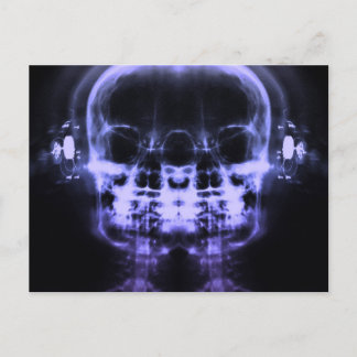 Double X-Ray Skulls with Headphones - Purple Postcard