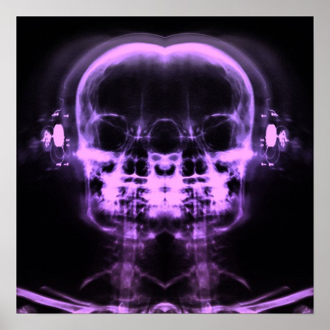 Double X-Ray Skulls with Headphones - Purple Poster (Front)