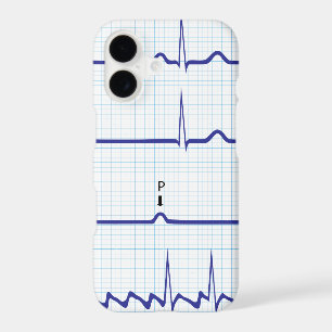 ECG/EKG iPhone case