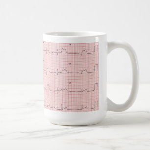 ECG mug