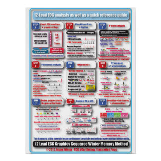 ECG Training Poster