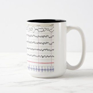 EEG Mug - REM Sleep