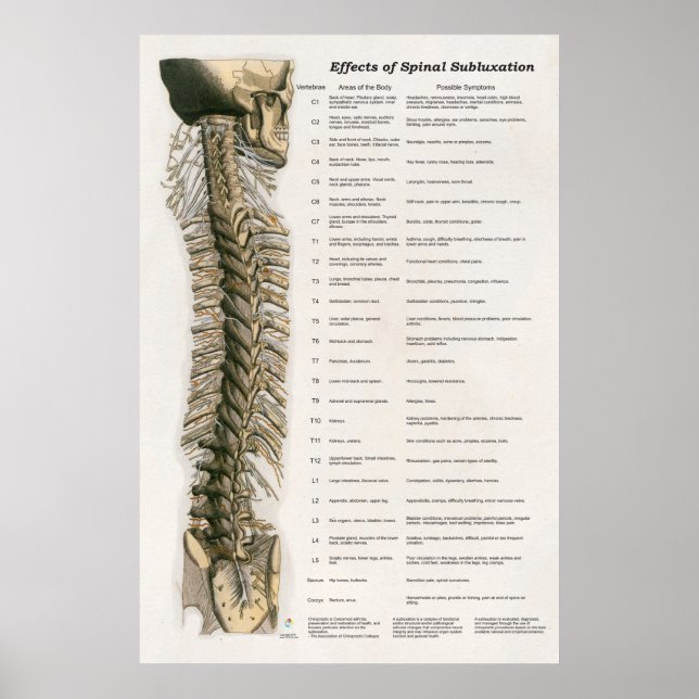 Effects of Spinal Subluxation Poster Chiropractic (Front)