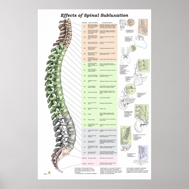 Effects of Spinal Subluxation Poster Chiropractic (Front)