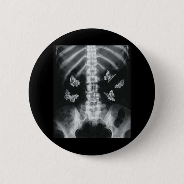 Egirl Skeleton Xray Butterfly Harajuku y2k Dark Ed 2 Inch Round Button (Front)