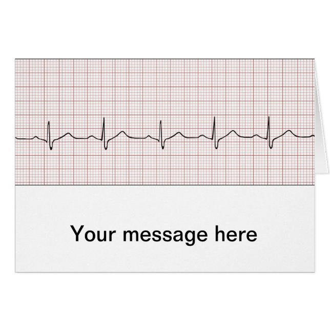 EKG heartbeat on graph paper, PhD (doctor) pulse (Front Horizontal)