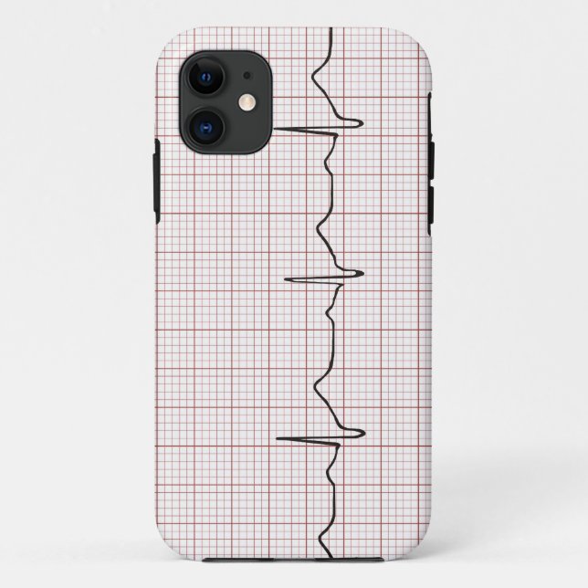 EKG heartbeat on graph paper, PhD (doctor) pulse Case-Mate iPhone Case (Back)