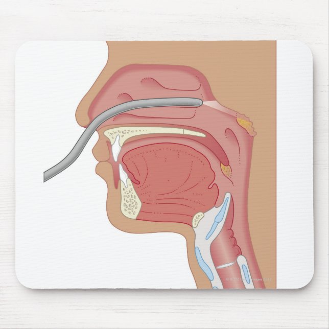 Endoscopy of the Nose Mouse Pad (Front)