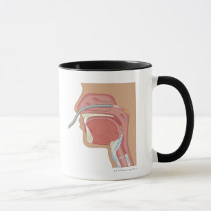 Endoscopy of the Nose Mug