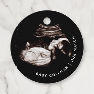 Étiquettes Cadeau Faire-part de grossesse Sonogramme bébé Cercle pho