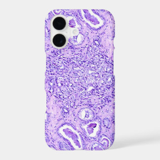 Étui de téléphone (nombreux modèles) - Cellules ca