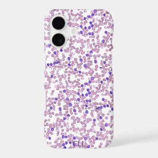 Étui de téléphone (nombreux modèles) - Leucémie ly