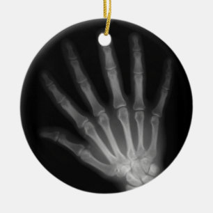 Extra Digit X-ray Left Hand Ceramic Ornament
