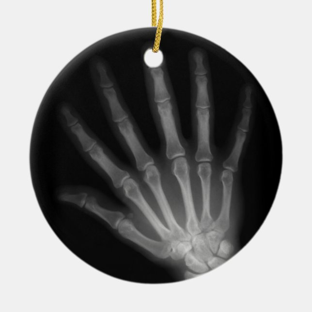 Extra Digit X-ray Left Hand Ceramic Ornament (Front)