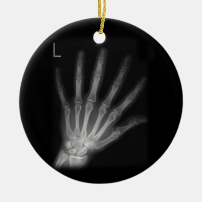 Extra Digit X-ray Left Hand Ceramic Ornament (Front)