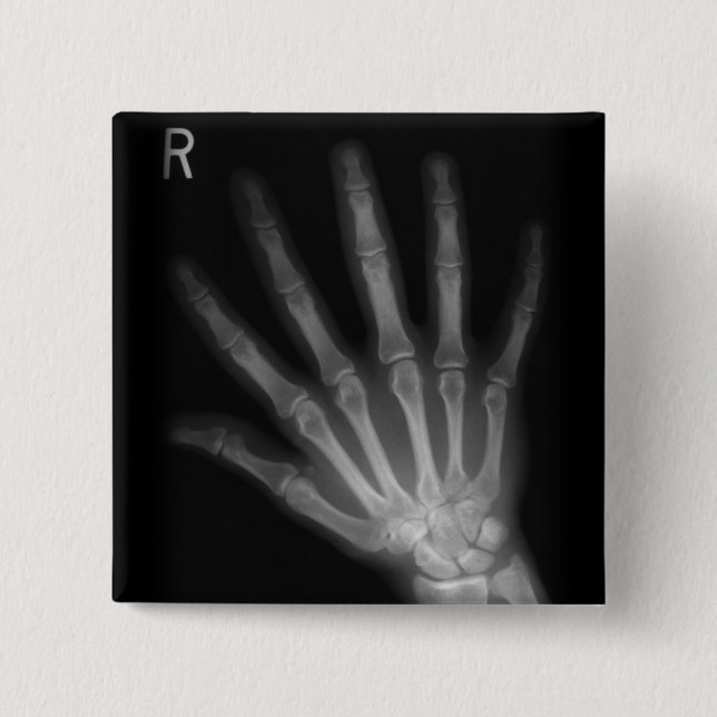 Extra Digit X-ray Right Hand 2 Inch Square Button (Front)