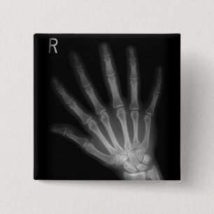 Extra Digit X-ray Right Hand 2 Inch Square Button