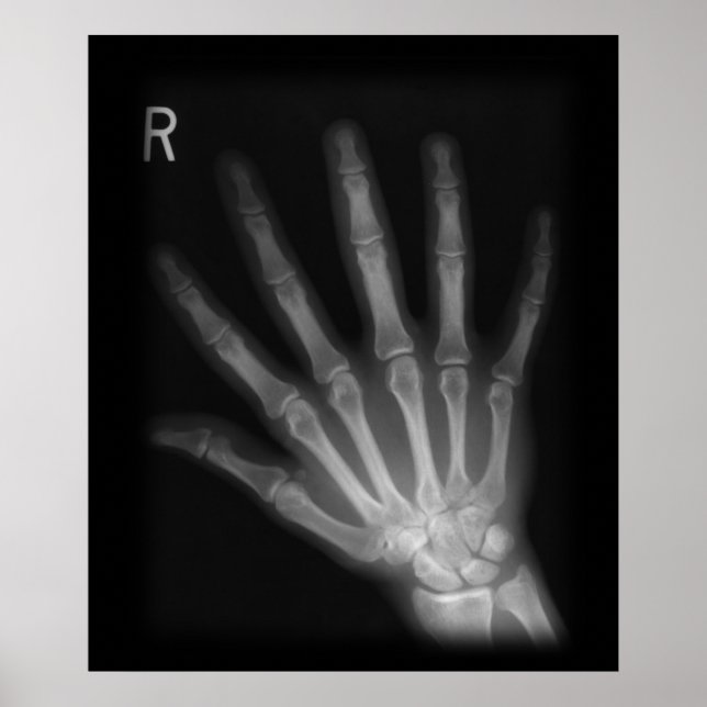 Extra Digit X-ray Right Hand Poster (Front)