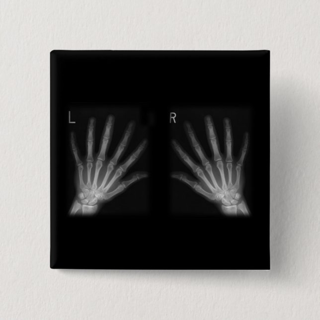 Extra Digit X-ray Right & Left Hands 2 Inch Square Button (Front)