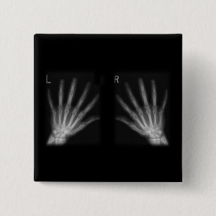 Extra Digit X-ray Right & Left Hands 2 Inch Square Button