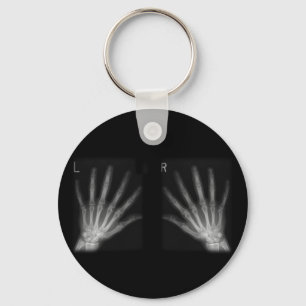 Extra Digit X-ray Right & Left Hands Keychain