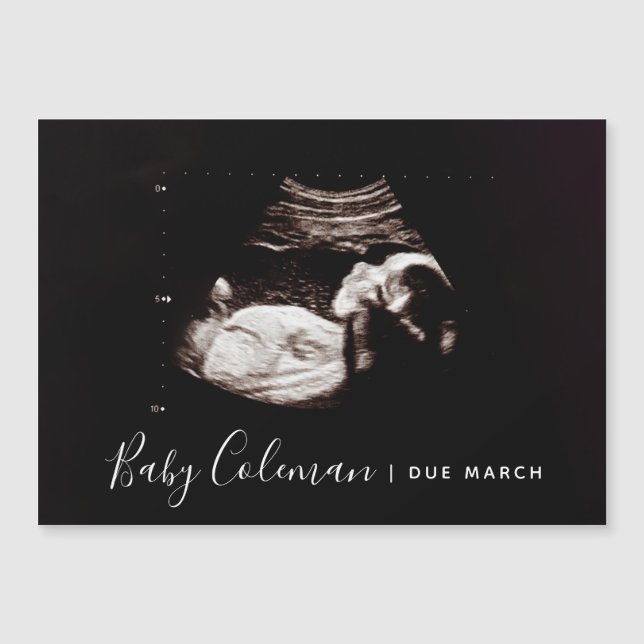 Faire-part de grossesse Sonogramme Nom de l'aimant (Devant)