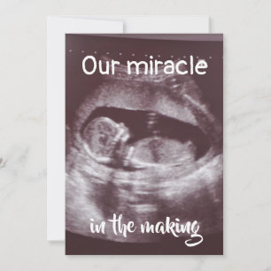 Faire-part Miracle In Making Ultrasound 2 Photo Baby Family