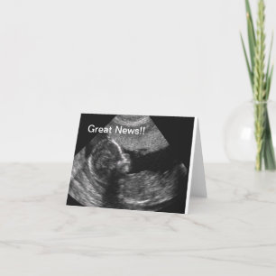Faire-part Nouvel ultrason de bébé