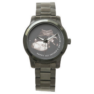 Father's Day Custom Name Photo Baby Sonogram  Watc Watch