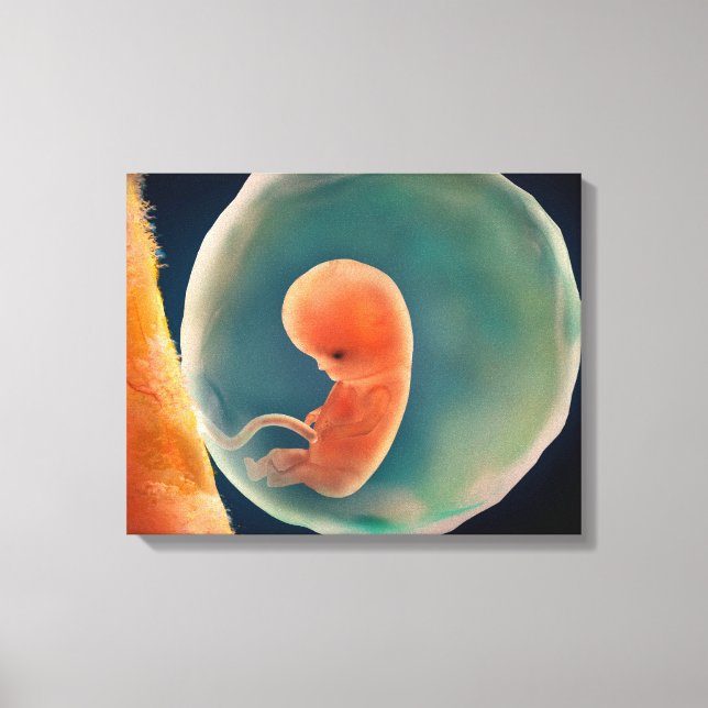 Fetus Development At 9 Weeks Canvas Print (Front)