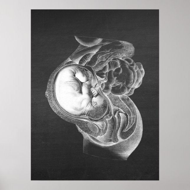 Fetus Womb Anatomy Obstetrics Decor no. 2 (Front)