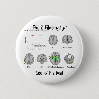 Fibromyalgia is real. fMRI proof 2 Inch Round Button