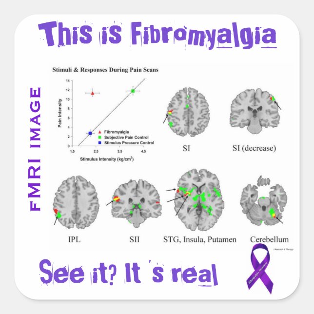 Fibromyalgia is real. You can see it on an fMRI Square Sticker (Front)