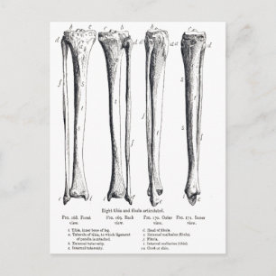 Fibula & Tibia  Postcard