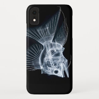 Fish X-Ray iPhone / iPad case