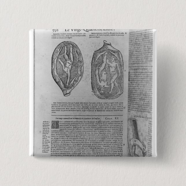Foetus, illustration from 'Oeuvres' 2 Inch Square Button (Front)