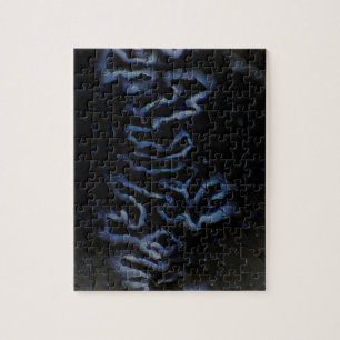 Fontanelle highlight puzzle