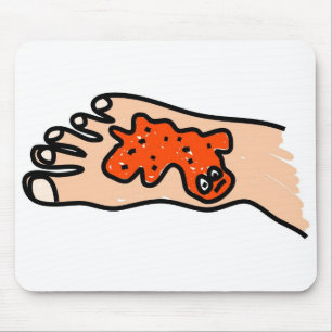 Foot Disease Mouse Pad