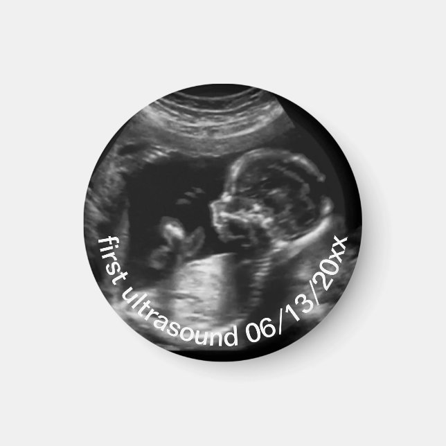 For New Mother First Ultrasound Sonogram Baby Magnet (Front)