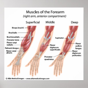 Forearm flexor muscles, labelled drawing. poster
