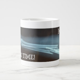 Fractured Radius and Ulna Xray "Break Time" Large Coffee Mug